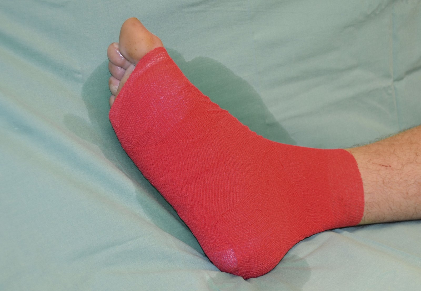 Fixier1li Fixierung einer Wundauflage mit einer elastischen Haftbinde